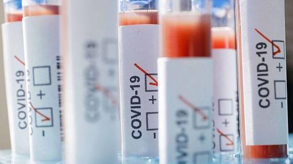 COMUNICAZIONE | Concluso screening con tamponi comunali. Tutti negativi. 